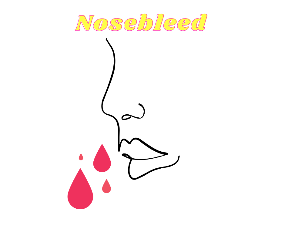 nose bleed